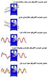 معرفي تکنولوژي الکتروفلو رويکردي يکپارچه براي بهبود کيفيت برق و کاهش تلفات Electro Flow Teqnology